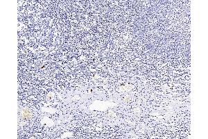Immunohistochemistry analysis of paraffin-embedded Human amygdalitis using ITGAX Polyclonal Antibody at dilution of 1:200. (CD11c antibody)