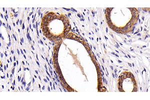 Detection of CK7 in Rat Uterus Tissue using Polyclonal Antibody to Cytokeratin 7 (CK7)