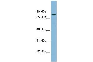 WB Suggested Anti-EPB41 Antibody Titration:  0.