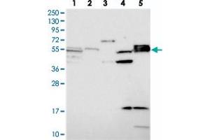Western blot analysis of Lane 1: RT-4, Lane 2: U-251 MG, Lane 3: Human Plasma, Lane 4: Liver, Lane 5: Tonsil with SRFBP1 polyclonal antibody  at 1:250-1:500 dilution. (SRFBP1 antibody)