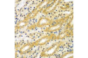 Immunohistochemistry of paraffin-embedded mouse kidney using ADCK3 antibody at dilution of 1:100 (x40 lens).