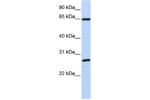 WB Suggested Anti-DNAJC1 Antibody Titration:  0. (DNAJC1 antibody  (C-Term))