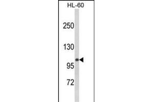 Western blot analysis of CASK (Center ) (ABIN6243846 and ABIN6578982) in HL-60 cell line lysates (35 μg/lane). (CASK antibody  (AA 262-291))