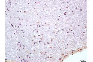 Formalin-fixed and paraffin embedded rat brain labeled with Anti-HSP70/HSPA1A Polyclonal Antibody, Unconjugated (ABIN1387822) at 1:200 followed by conjugation to the secondary antibody and DAB staining (HSP70 1A/ 1B (AA 500-600) antibody)