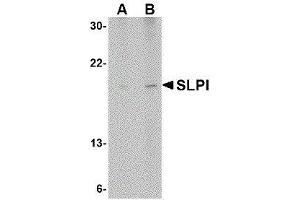 Western Blotting (WB) image for anti-Secretory Leukocyte Peptidase Inhibitor (SLPI) (Center) antibody (ABIN2476522) (SLPI antibody  (Center))