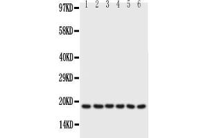 Anti-PLN antibody, Western blottingAll lanes: Anti PLN  at 0. (Phospholamban antibody  (N-Term))
