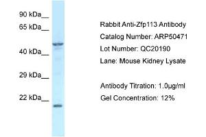WB Suggested Anti-Zfp113 Antibody   Titration: 1. (Zfp113 antibody  (Middle Region))