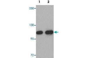 Western blot analysis of mouse liver tissue with CDC27 polyclonal antibody  at (Lane 1) 1 and (Lane 2) 2 ug/mL dilution.