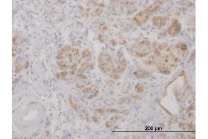 Immunoperoxidase of purified MaxPab antibody to LCN2 on formalin-fixed paraffin-embedded human pancreas. (Lipocalin 2 antibody  (AA 1-198))