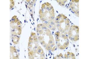 Immunohistochemistry of paraffin-embedded Human stomach using CBR4 Polyclonal Antibody at dilution of 1:100 (40x lens). (CBR4 antibody)