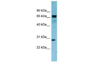 RASL12 antibody used at 1 ug/ml to detect target protein. (RASL12 antibody  (N-Term))
