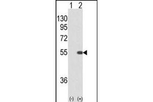 Western blot analysis of STK40 (arrow) using rabbit polyclonal STK40 (C-term) (ABIN652973 and ABIN2842617). (STK40 antibody  (C-Term))