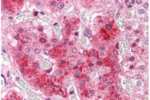 Human Adrenal: Formalin-Fixed, Paraffin-Embedded (FFPE) (COMT antibody  (N-Term))