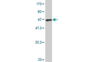 Western Blot detection against Immunogen (61. (FVT1 antibody  (AA 12-332))