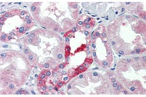 Immunohistochemistry with Human kidney lysate tissue at an antibody concentration of 5. (SLC25A28 antibody  (C-Term))