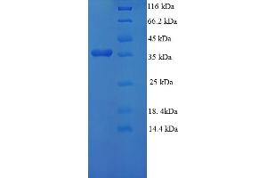 SDS-PAGE (SDS) image for gamma-Glutamylcyclotransferase (GGCT) (AA 1-188), (full length) protein (His-SUMO Tag) (ABIN4975665)
