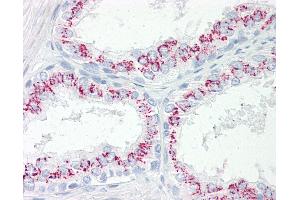Anti-CPEB3 antibody IHC of human prostate.