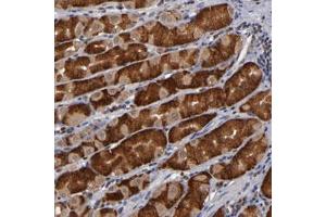 Immunohistochemical staining of human stomach with ALG13 polyclonal antibody  shows strong cytoplasmic positivity in glandular cells. (ALG13 antibody)