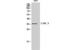 Western Blotting (WB) image for anti-CCAAT/enhancer Binding Protein (C/EBP), beta (CEBPB) (Ser243) antibody (ABIN3174087) (CEBPB antibody  (Ser243))