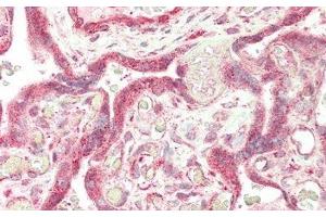 Detection of FUR in Human Placenta Tissue using Polyclonal Antibody to Furin (FUR) (FURIN antibody  (AA 385-500))