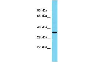 Host: Rabbit Target Name: C1orf222 Sample Type: Fetal Heart lysates Antibody Dilution: 1. (CFAP74/KIAA1751 antibody  (C-Term))
