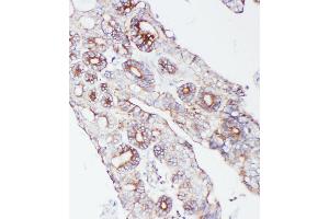 Immunohistochemistry (IHC) image for anti-Proprotein Convertase Subtilisin/kexin Type 9 (PCSK9) (AA 671-687), (C-Term) antibody (ABIN3042887)