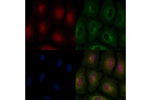 ABIN6263071 and ABIN6266879 staining  cells by IF/ICC. (Melanoma Antigen Family D, 4 (MAGED4) (C-Term) antibody)