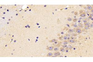 Detection of PEDF in Rat Cerebrum Tissue using Polyclonal Antibody to Pigment Epithelium Derived Factor (PEDF) (PEDF antibody  (AA 20-418))