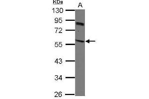 WB Image Sample (30 ug of whole cell lysate) A: K562 10% SDS PAGE antibody diluted at 1:1000 (SIRPG antibody)