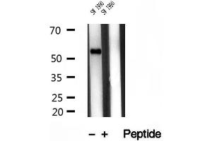 Western blot analysis of extracts of SW 1990 cells, using TMPRSS4 antibody. (TMPRSS4 antibody  (Internal Region))