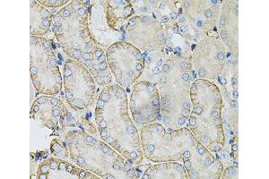Immunohistochemistry of paraffin-embedded Mouse kidney using SLC4A4 / NBC Polyclonal Antibody at dilution of 1:100 (40x lens).