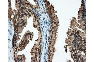 Immunohistochemical staining of paraffin-embedded liver tissue using anti-CUGBP1 mouse monoclonal antibody. (CELF1 antibody)