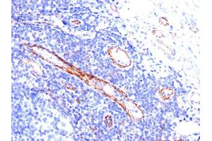 Immunohistochemistry (IHC) image for anti-Platelet/endothelial Cell Adhesion Molecule (PECAM1) antibody (ABIN6940282)