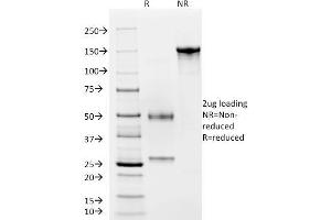 SDS-PAGE Analysis Purified vWF Recombinant Mouse Monoclonal Antibody (rVWF/2480). (Recombinant VWF antibody)