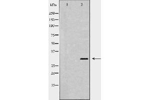 Western blot analysis of extracts of HEK-293, using XPA antibody. (XPA antibody  (Internal Region))