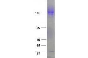 Western Blotting (WB) image for Echinoderm Microtubule Associated Protein Like 4 (EML4) (Transcript Variant 1) protein (Myc-DYKDDDDK Tag) (ABIN2720153)
