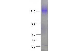 Validation with Western Blot (EML4 Protein (Transcript Variant 1) (Myc-DYKDDDDK Tag))