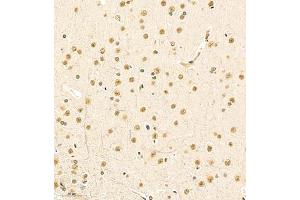 Immunohistochemistry (Paraffin-embedded Sections) (IHC (p)) image for anti-Mediator Complex Subunit 17 (MED17) antibody (ABIN7074579)