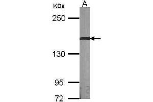 WB Image Sample (30 ug of whole cell lysate) A:NIH-3T3 5% SDS PAGE antibody diluted at 1:1000 (AUTS2 antibody  (Internal Region))