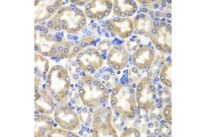 Immunohistochemistry of paraffin-embedded mouse liver using HADH antibody. (HADH antibody)