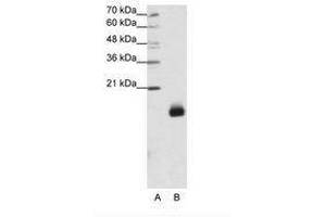 Image no. 1 for anti-Ribosomal Protein S14 (RPS14) (N-Term) antibody (ABIN203013) (RPS14 antibody  (N-Term))