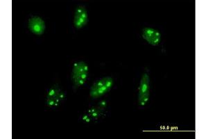 Immunofluorescence of purified MaxPab antibody to C1orf87 on HeLa cell. (C1orf87 antibody  (AA 1-546))
