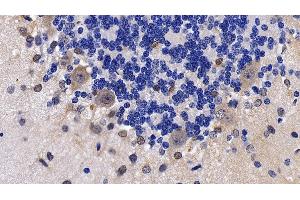 Detection of NPS in Rat Cerebellum Tissue using Polyclonal Antibody to Neuropeptide S (NPS) (NPS antibody  (AA 26-89))