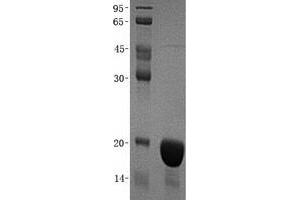Validation with Western Blot (CDKN2C Protein (Transcript Variant 1) (His tag))