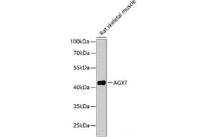 Western blot analysis of extracts of Rat skeletal muscle using AGXT Polyclonal Antibody at dilution of 1:1000. (AGXT antibody)