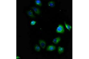 Immunofluorescence staining of A549 cells with ABIN7169933 at 1:100, counter-stained with DAPI. (SCN1B antibody  (AA 44-156))