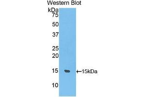 Western blot analysis of the recombinant protein. (UCP1 antibody  (AA 179-296))
