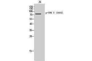 Western Blotting (WB) image for anti-Adrenergic, Beta, Receptor Kinase 1 (ADRBK1) (pSer685) antibody (ABIN3173109) (GRK2 antibody  (pSer685))