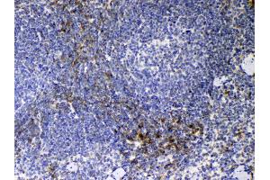 IHC analysis of CD14 using anti-CD14 antibody . (CD14 antibody  (AA 16-260))