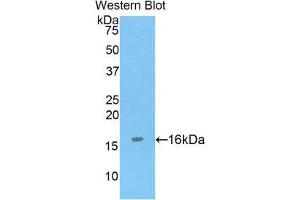 Western Blotting (WB) image for anti-ADAM Metallopeptidase with Thrombospondin Type 1 Motif, 7 (ADAMTS7) (AA 226-437) antibody (ABIN1857907) (ADAMTS7 antibody  (AA 226-437))